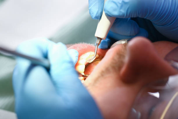 Best Emergency Denture Repair in Houston, PA