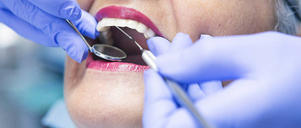Best Emergency Dental Care for Broken or Chipped Teeth in Houston, PA